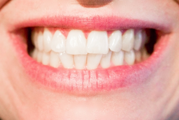 imagem: sorriso