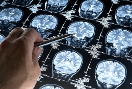 Projeto da UFF alia psiquiatria à inteligência artificial