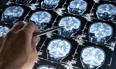 Projeto da UFF alia psiquiatria à inteligência artificial